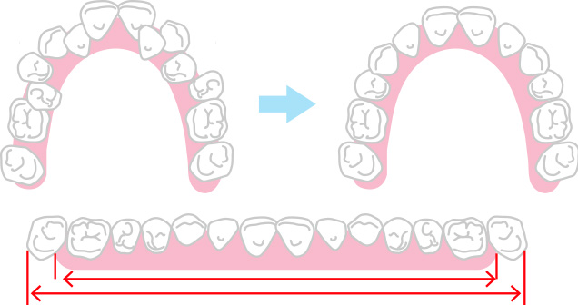 歯と顎の大きさの比率